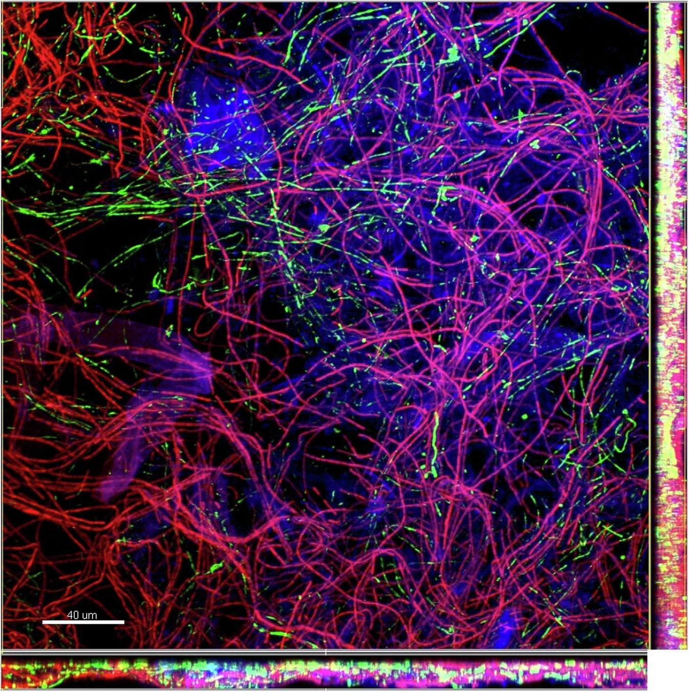 magenta, cobalt and fluorescent green squiggly lines densely cross a black background.