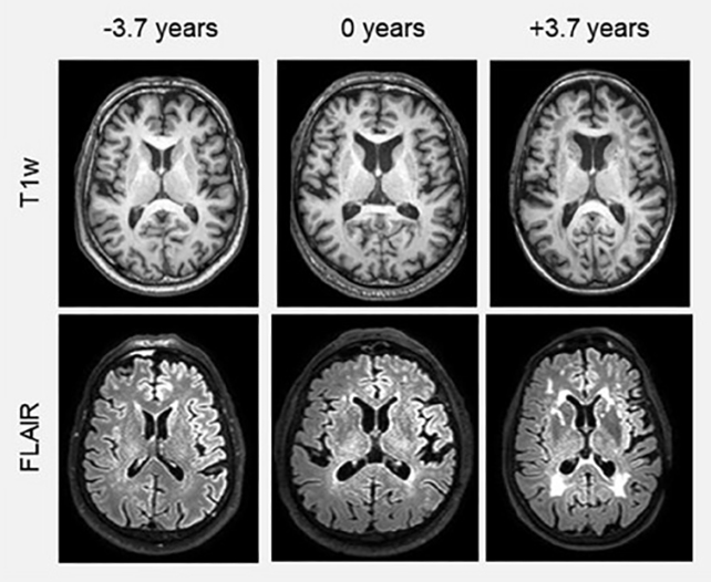 Brain scans