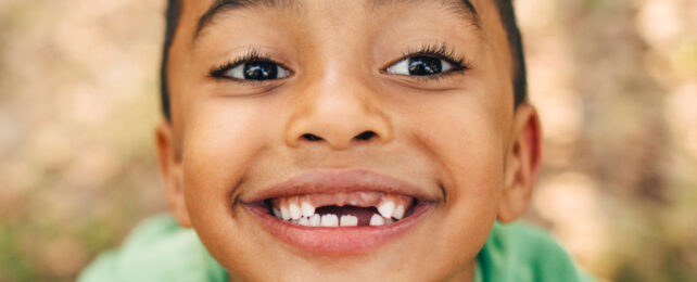 young child with missing front teeth