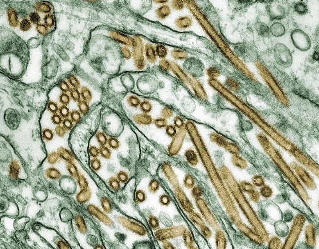 Colorized transmission electron micrograph of Avian influenza A H5N1 viruses