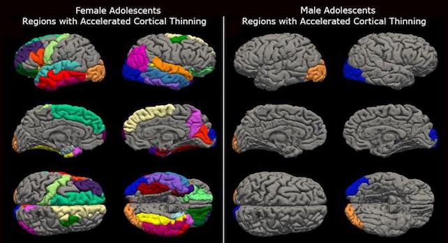 brain scans show faster maturation of teenagers' brains following the COVID-19 pandemic