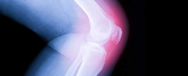 knee xray