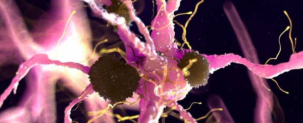 A pink neuron with protein clumps