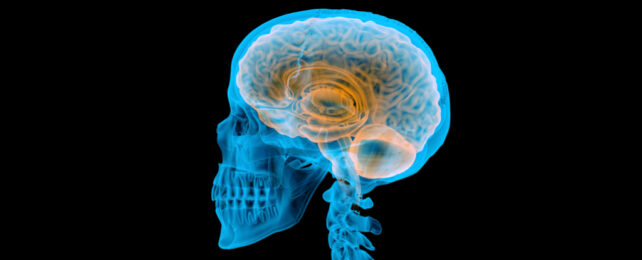 x-ray image of skull and brain